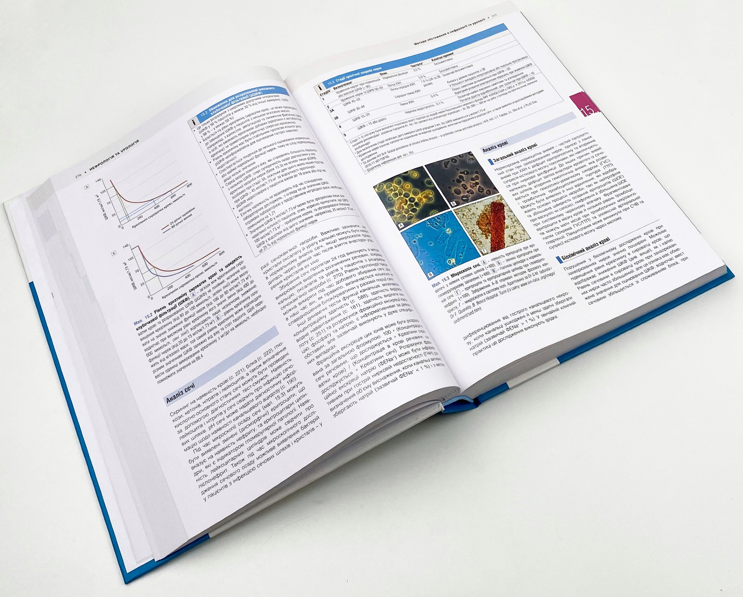 Медицина за Девідсоном: принципи і практика: 23-є видання: у 3 томах. Том 2. Автор — Стюарт Г Ралстон, Ян Д Пенман, Марк В Дж Стрекен, Річарда П Гобсон. 