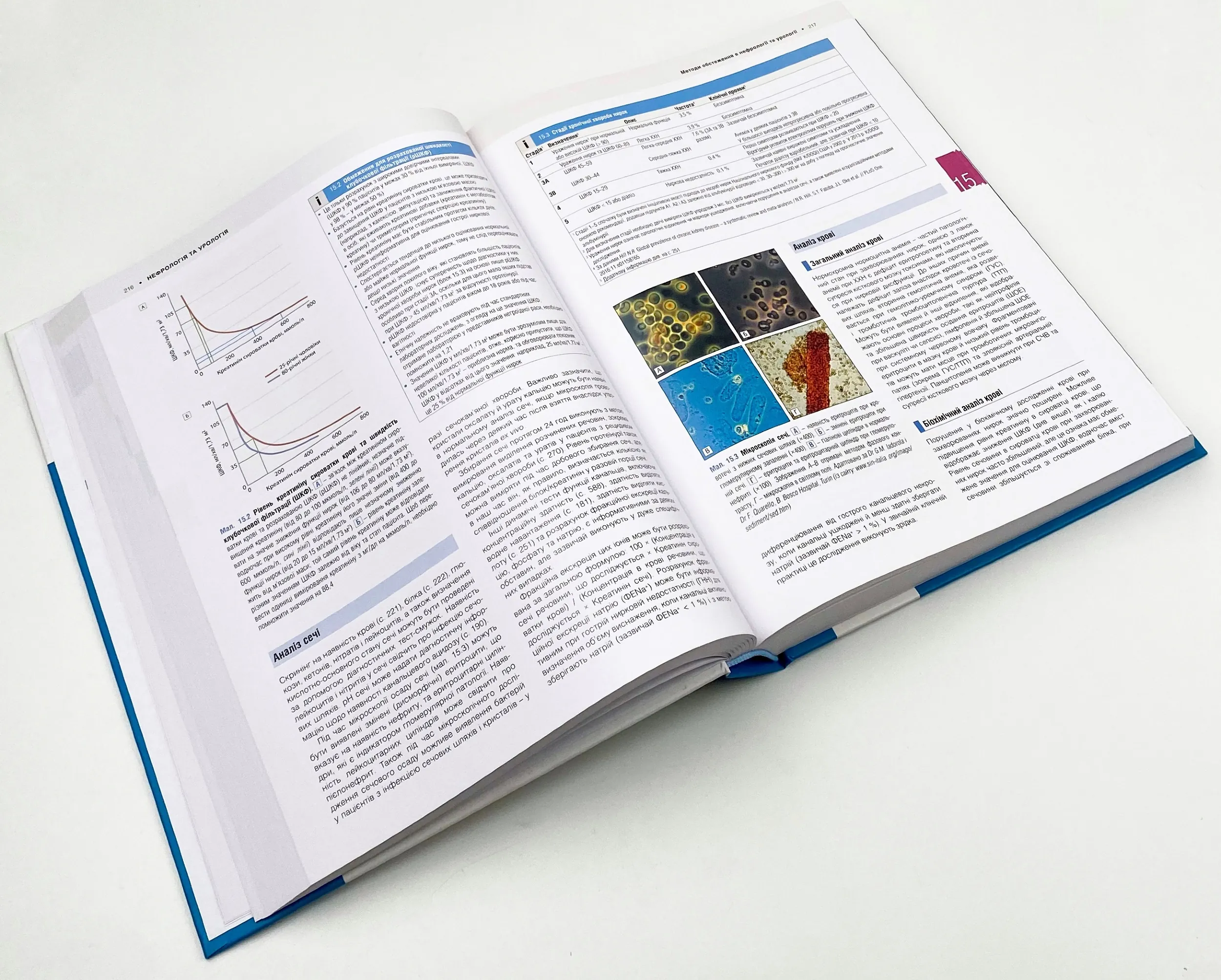 Медицина за Девідсоном: принципи і практика: 23-є видання: у 3 томах. Том 2. Автор — Стюарт Г Ралстон, Ян Д Пенман, Марк В Дж Стрекен, Річарда П Гобсон. 