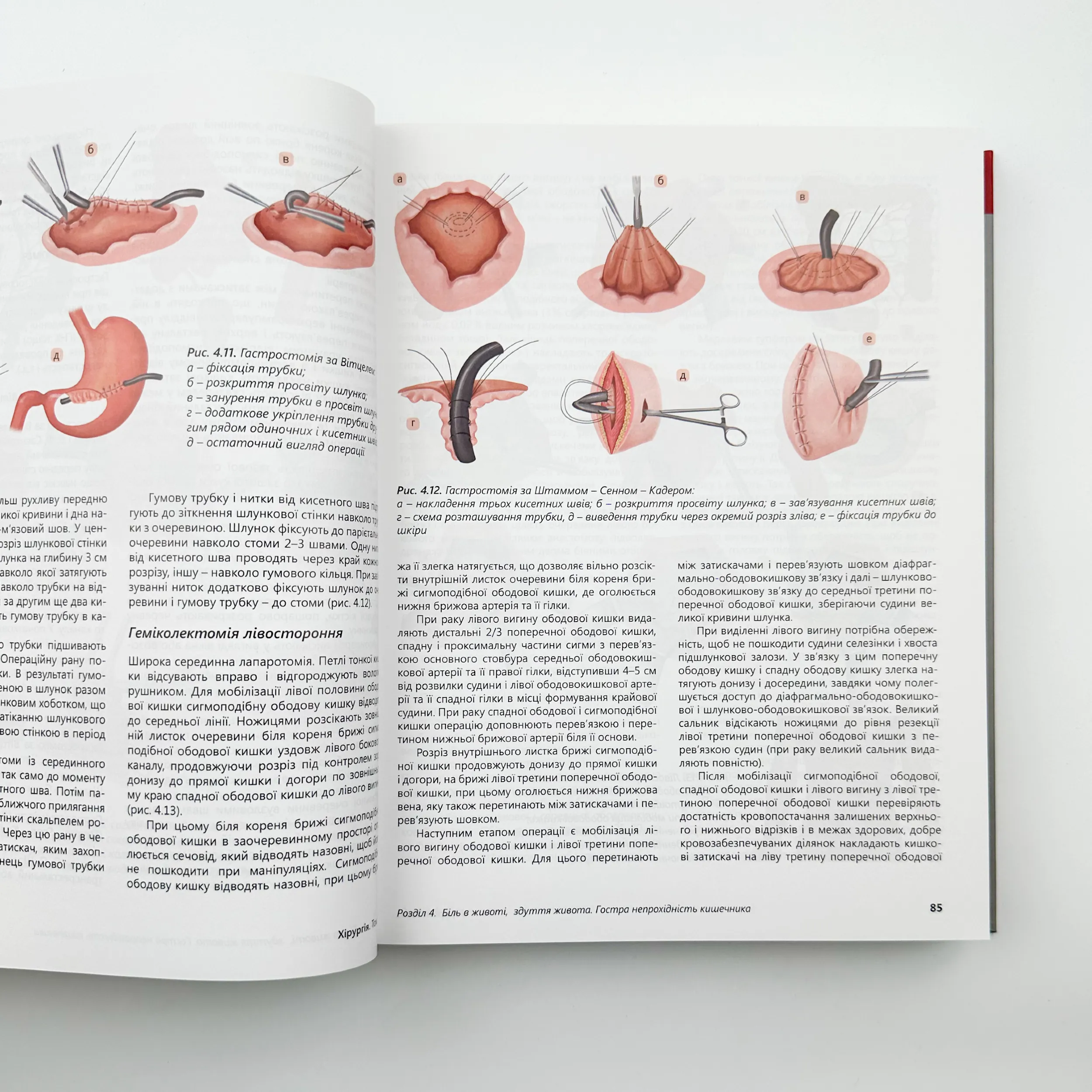 Хірургія. Т.1. . Автор — Кондратенко П.Г.. 