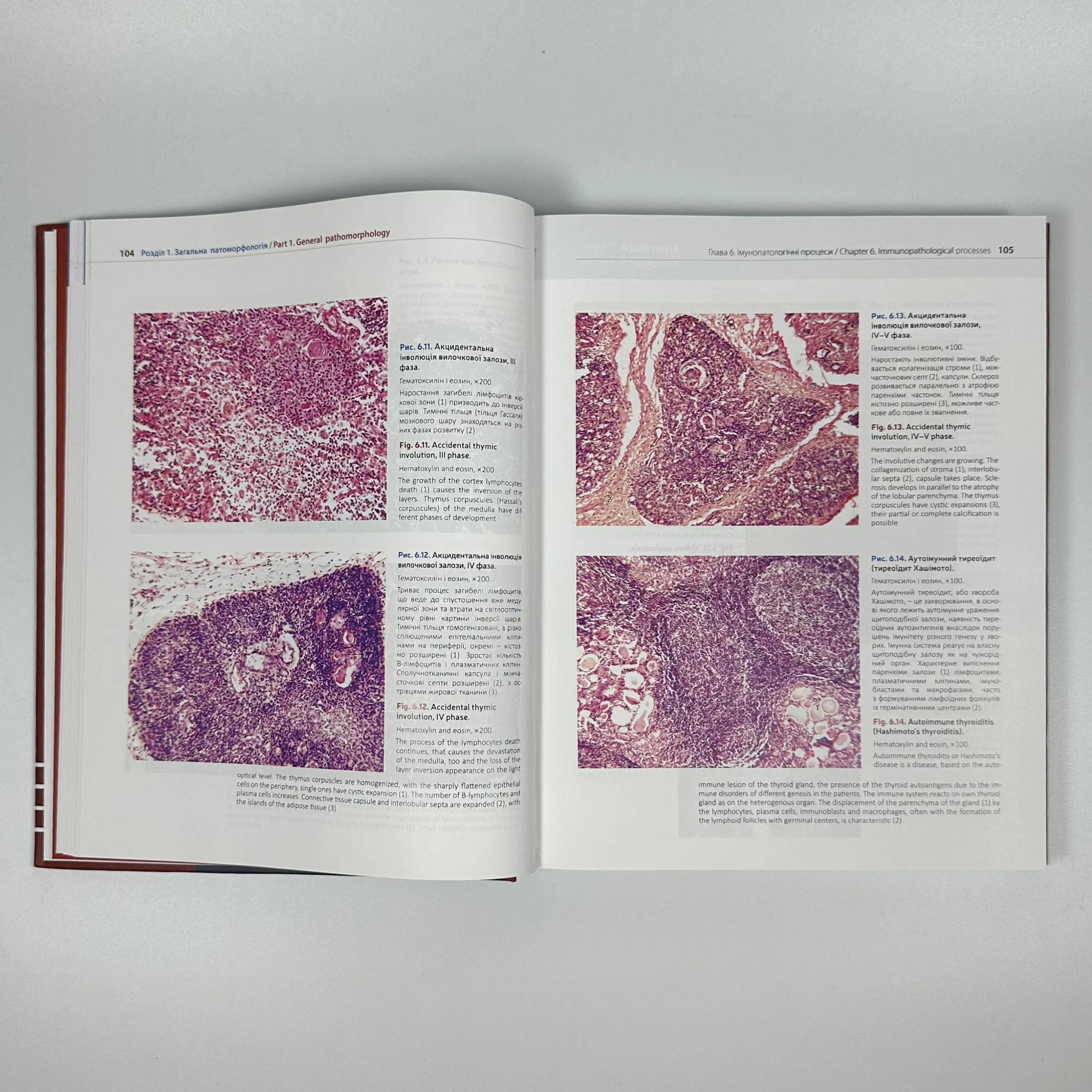 Патоморфологія = Pathomorphology: атлас укр. та англ. мовами. Автор — Боднар Я.Я., Багрій М.М.. 