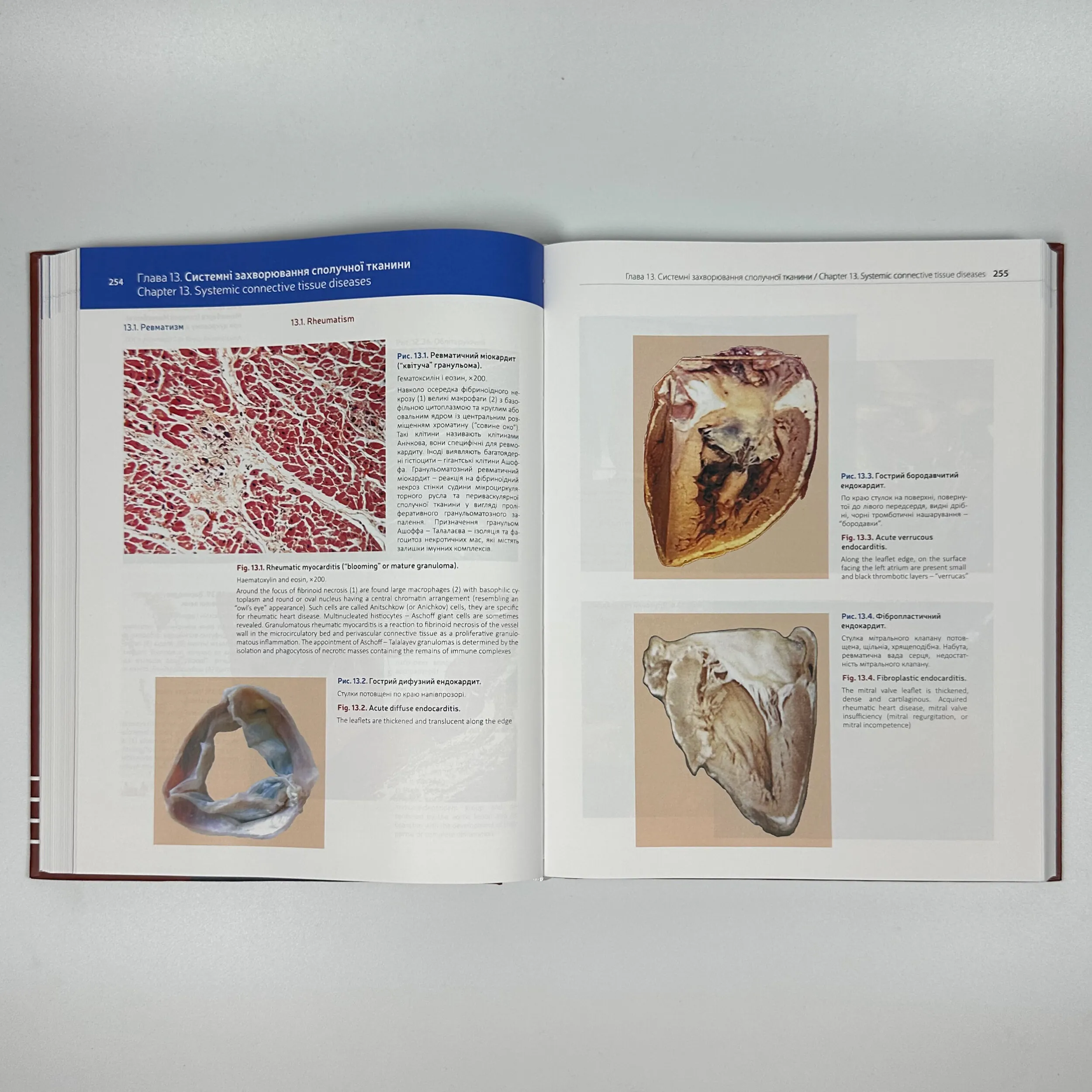 Патоморфологія = Pathomorphology: атлас укр. та англ. мовами. Автор — Боднар Я.Я., Багрій М.М.. 