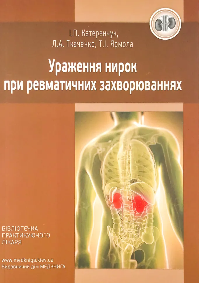 Ураження нирок при ревматичних захворюваннях. Автор — Катеренчук І.П., Ткаченко Л.А.