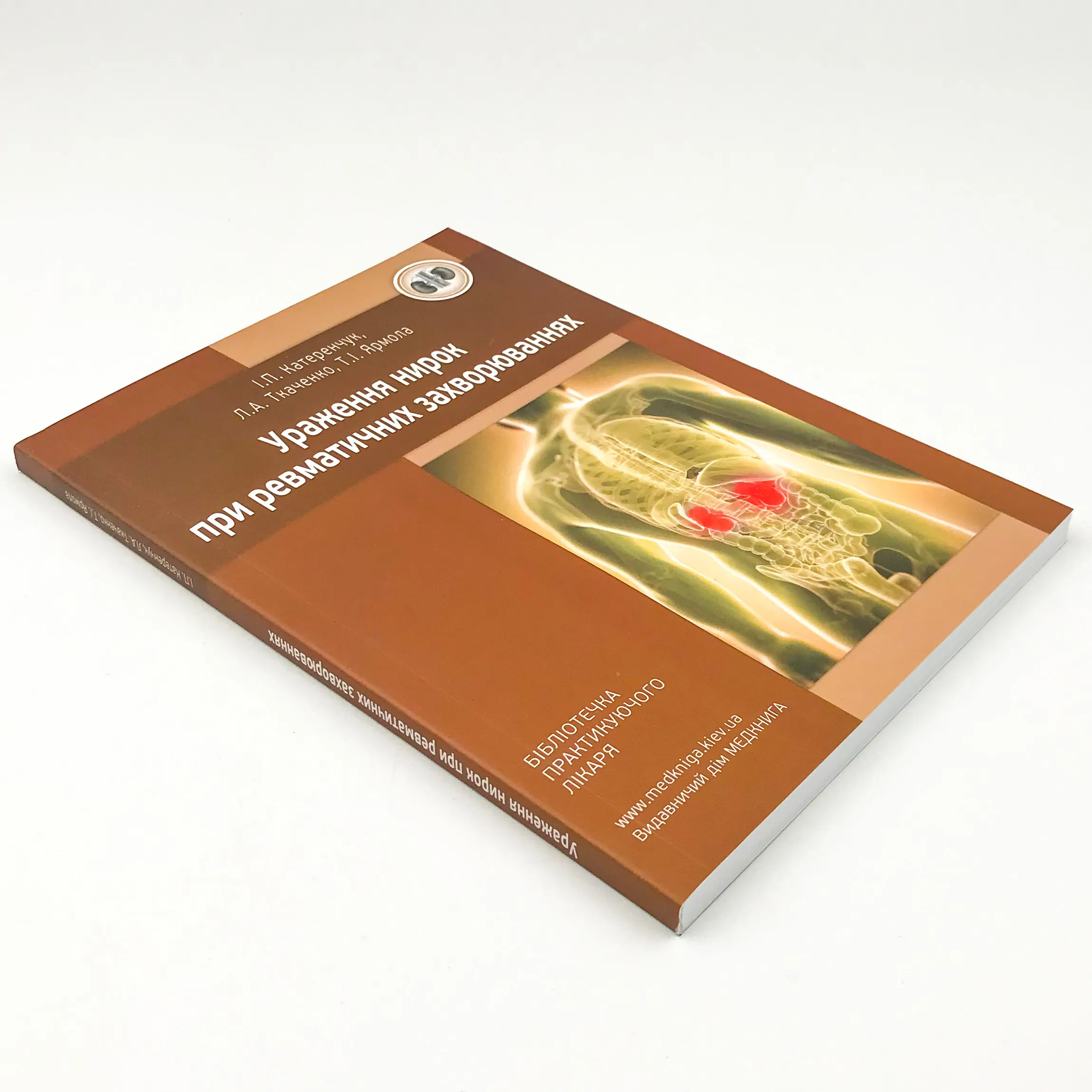 Ураження нирок при ревматичних захворюваннях