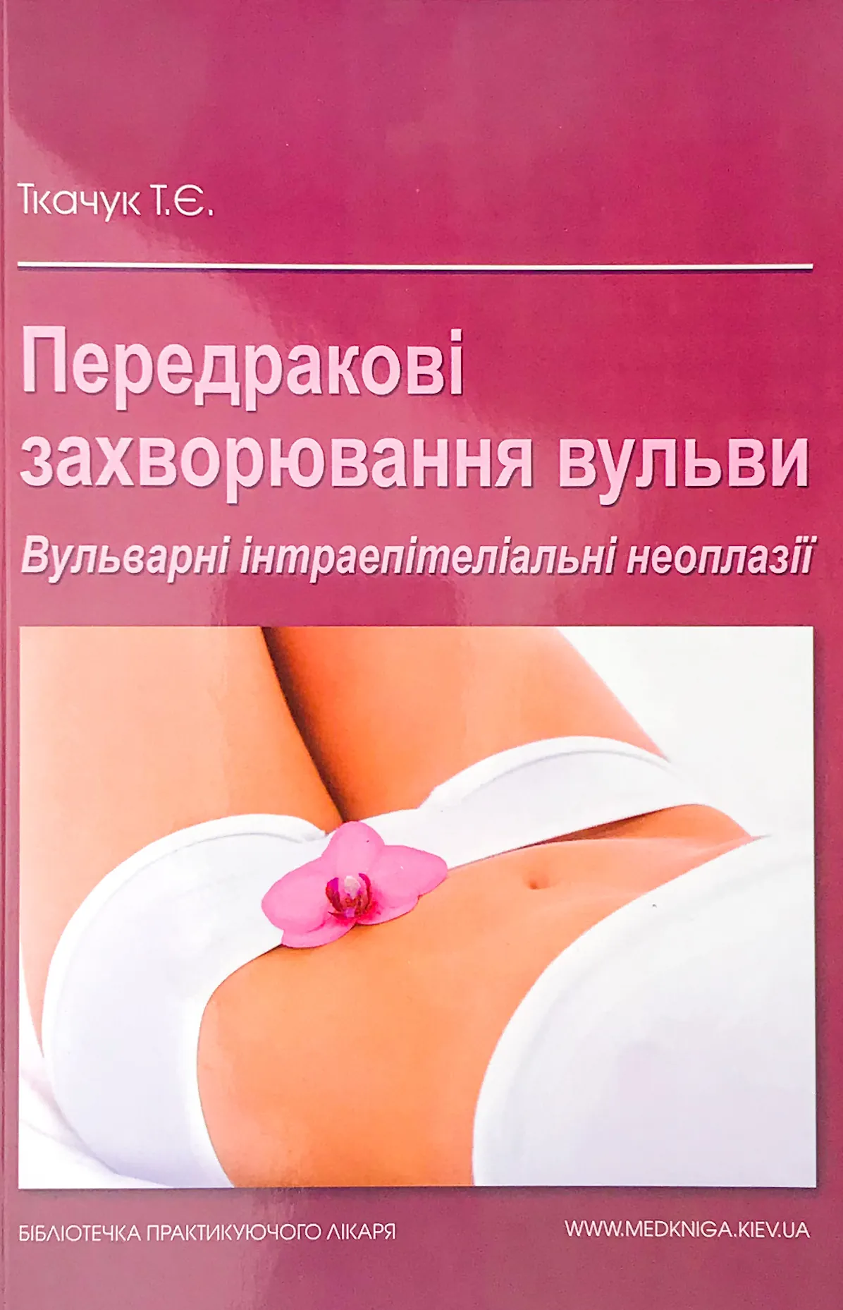 Передракові захворювання вульви. Вульварні інтраепітеліальні неоплазії