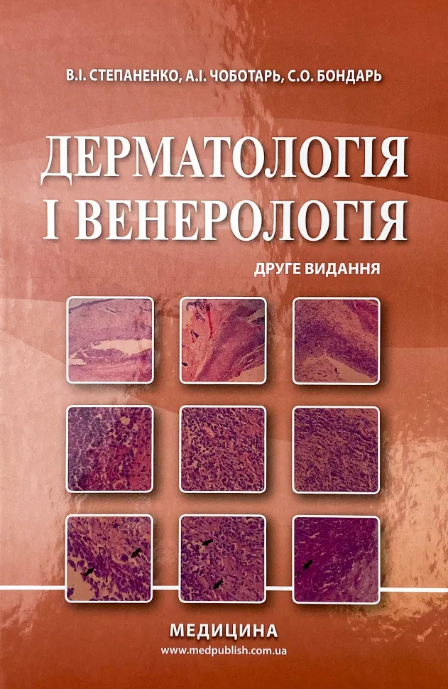 Дерматологія і венерологія. Автор — В.І Степаненко, А.І Чоботарь. Обкладинка — Тверда