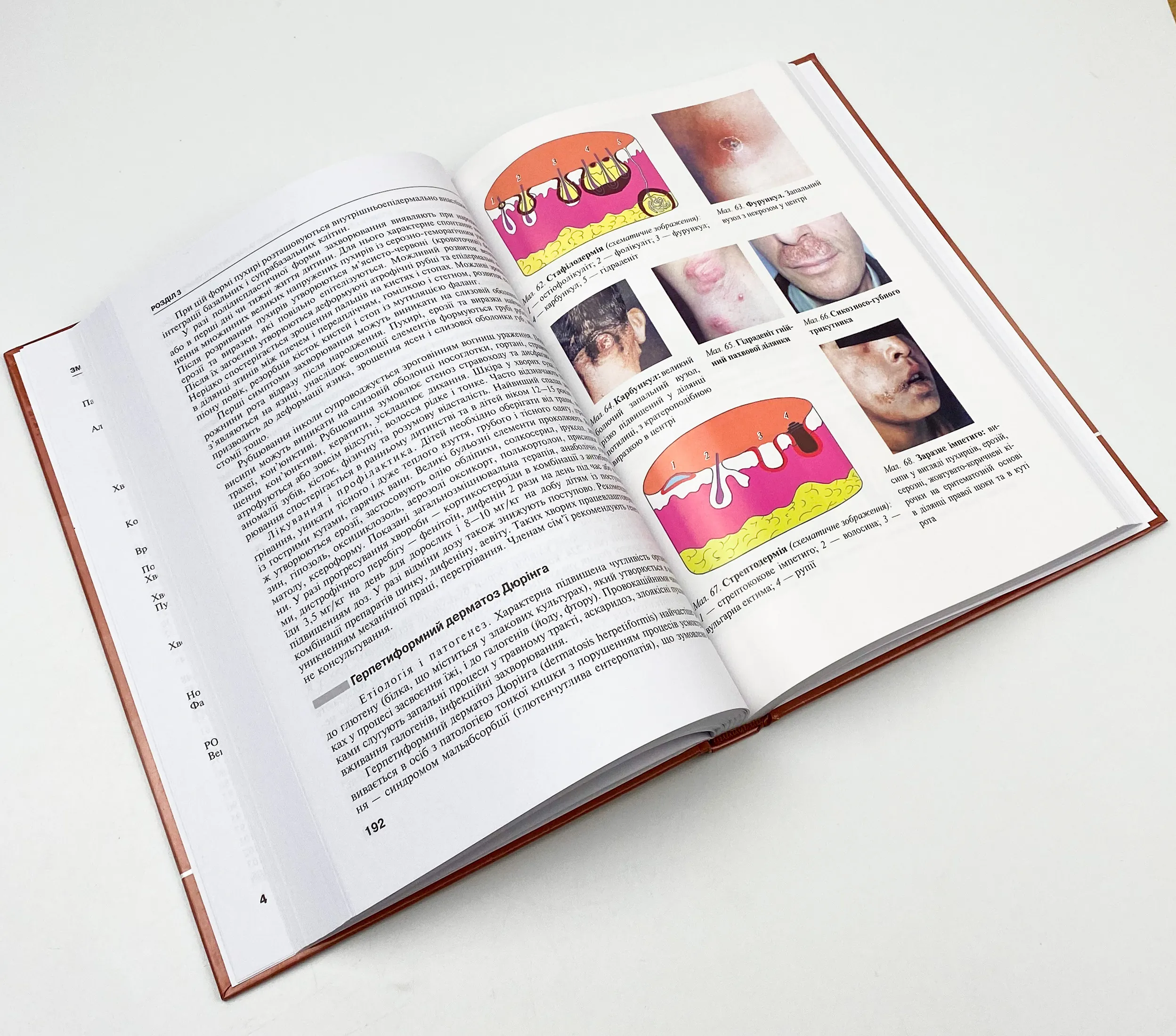 Дерматологія і венерологія. Автор — В.І Степаненко, А.І Чоботарь, С.О Бондарь. 