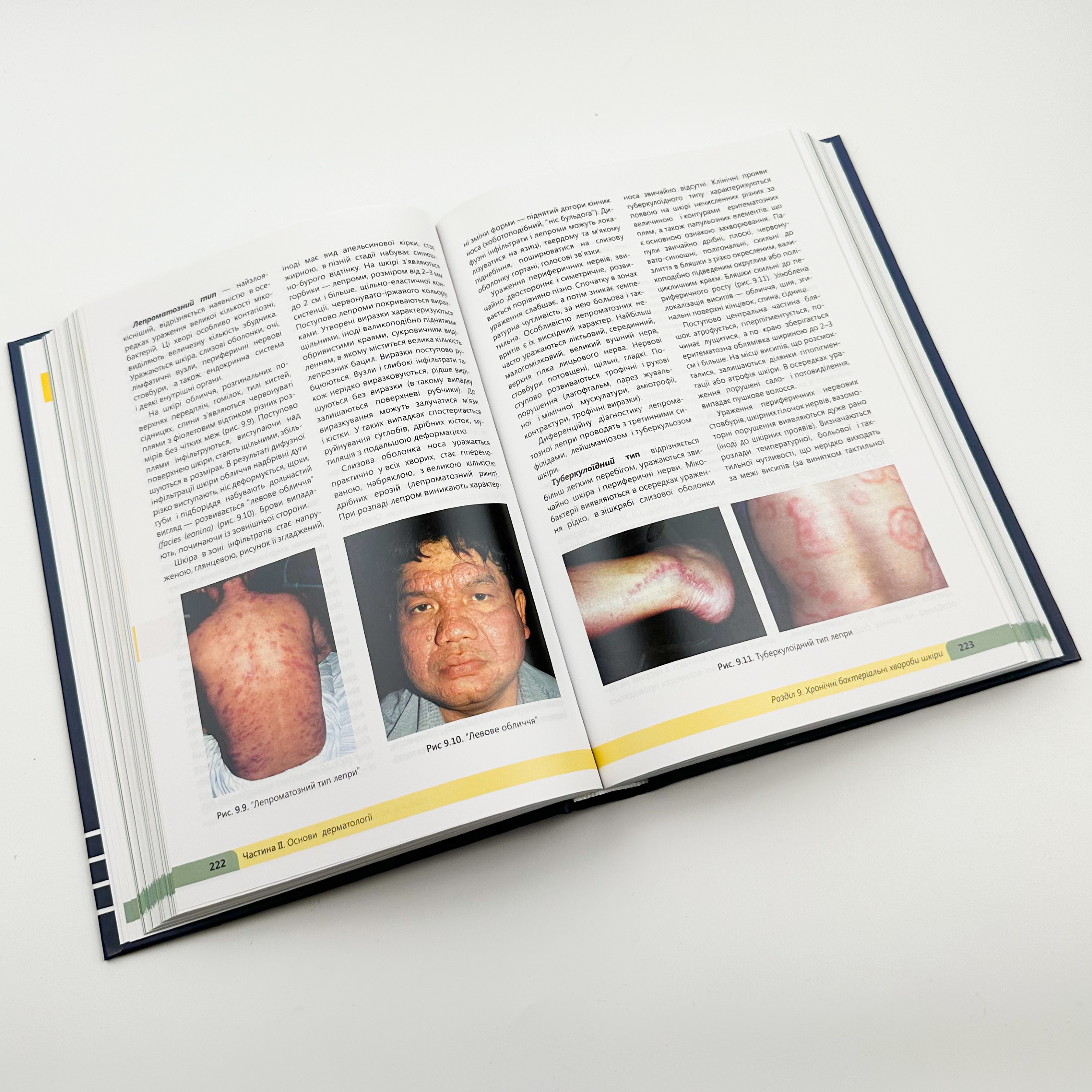 Дерматологія. Венерологія . Автор — Свистунов І.В.. 