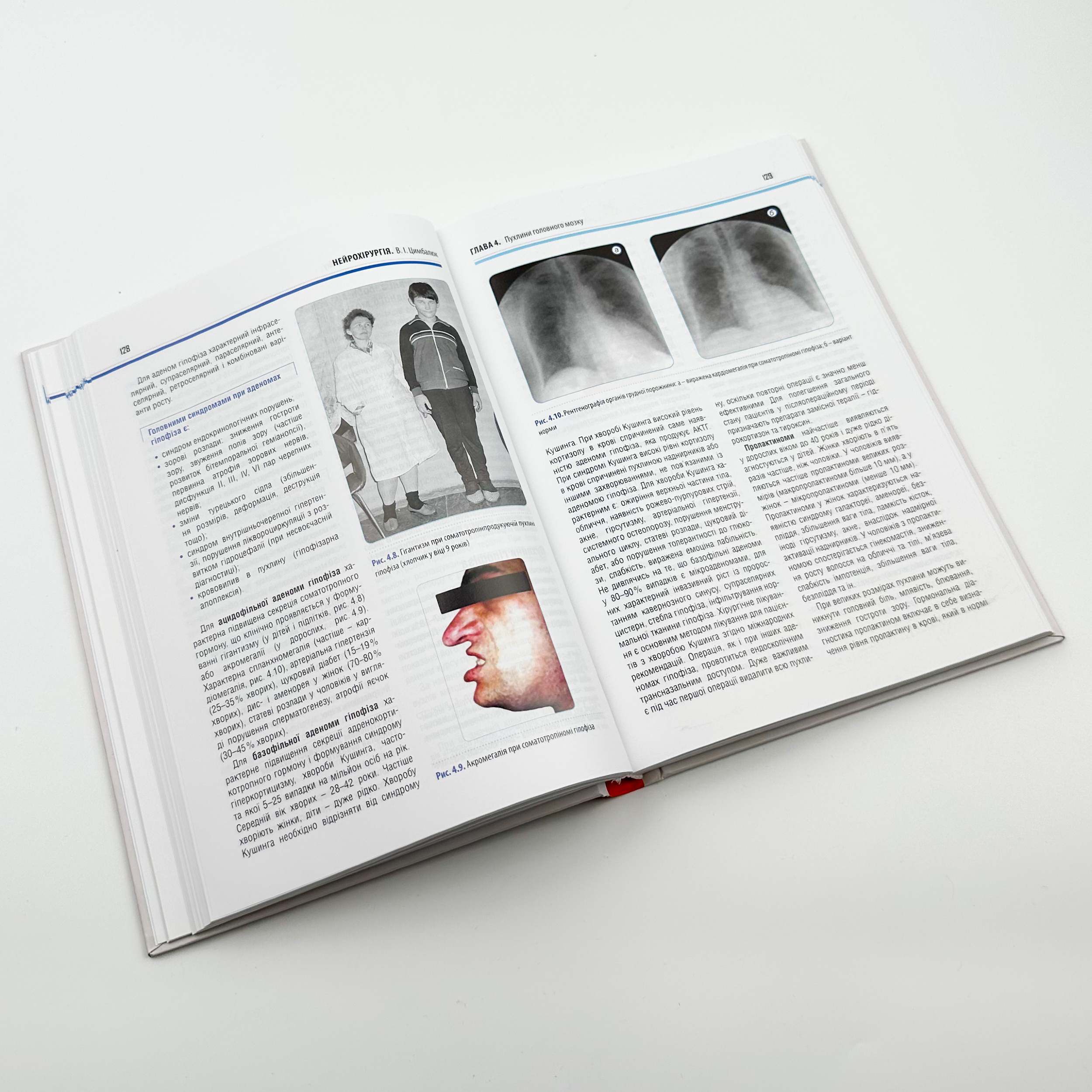 Нейрохірургія. Автор — Цимбалюк В. І.. 