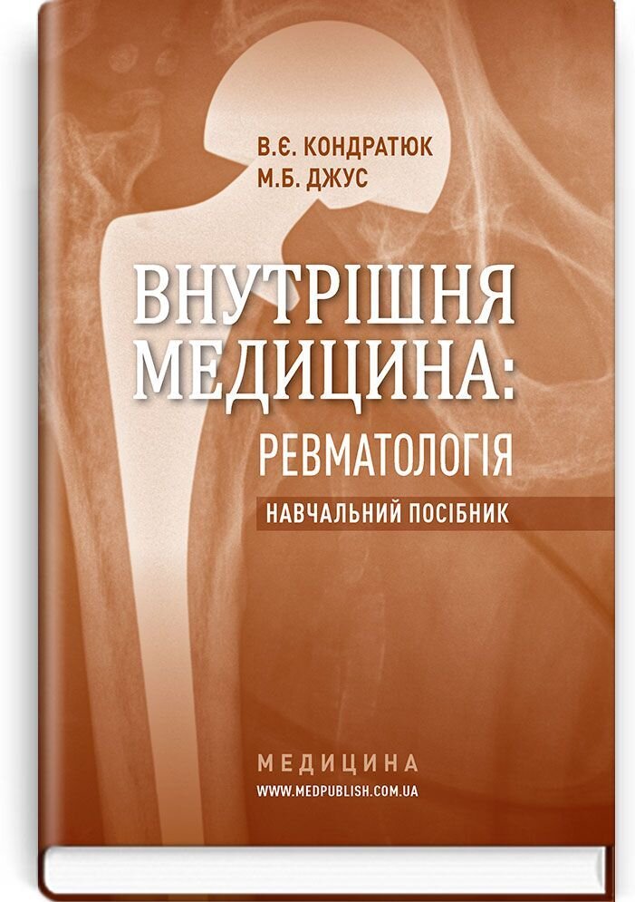 Внутрішня медицина: Ревматологія: навчальний посібник (ВНЗ післядипломної освіти). Автор — В.Є Кондратюк, М.Б Джус. 