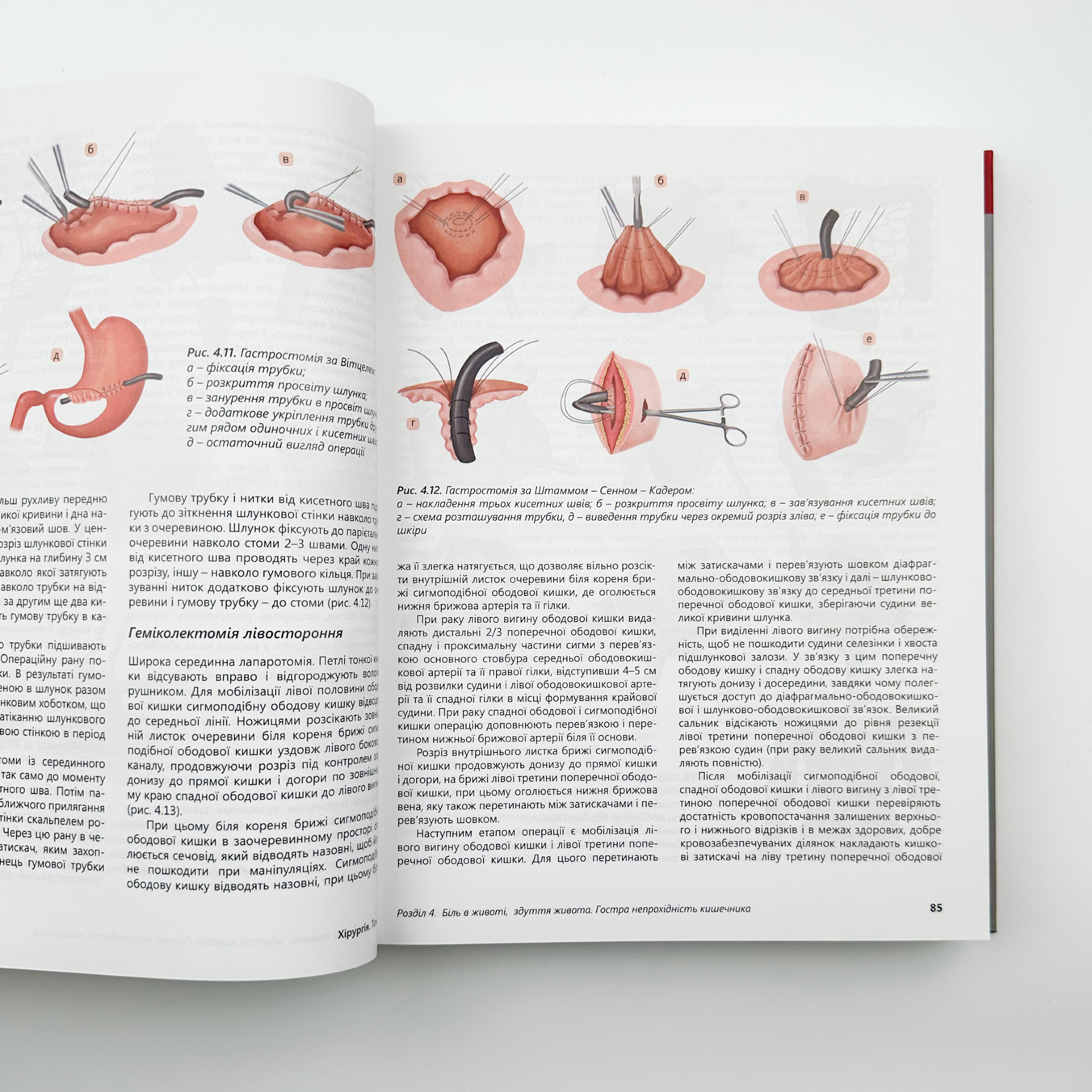 Хірургія Т.1.. Автор — Кондратенко П.Г.. 