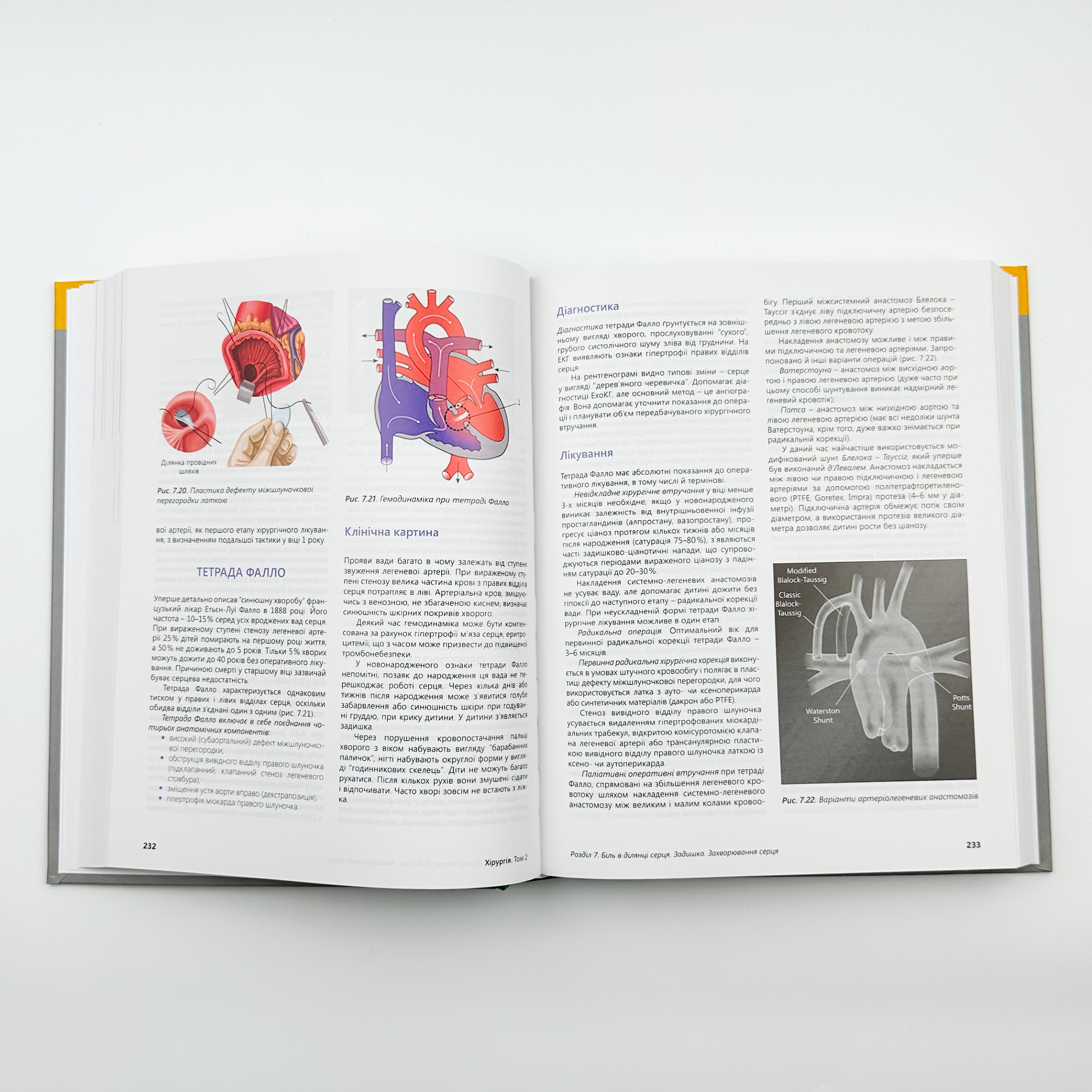 Хірургія. Т.2. . Автор — Кондратенко П.Г.. 