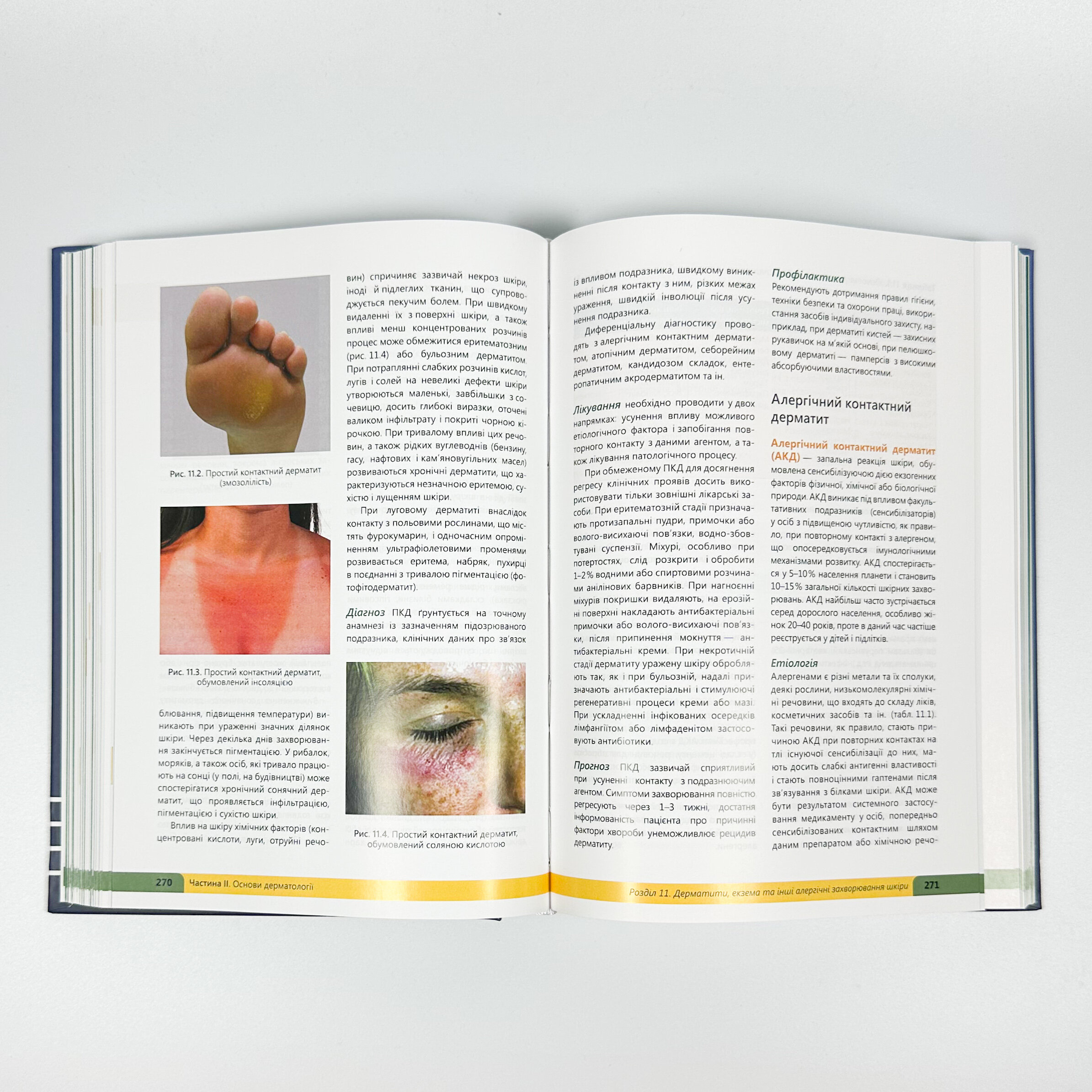 Дерматологія. Венерологія = Dermatology. Venereology: атлас укр. та англ. мовами. Автор — Свистунов І.В., Святенко А.В.. 