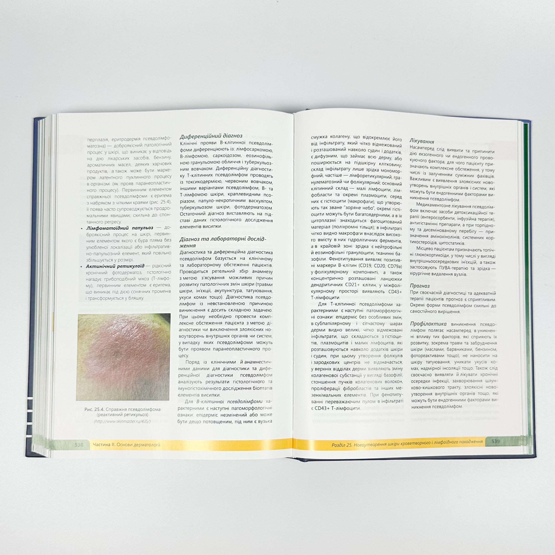 Дерматологія. Венерологія = Dermatology. Venereology: атлас укр. та англ. мовами. Автор — Свистунов І.В., Святенко А.В.. 