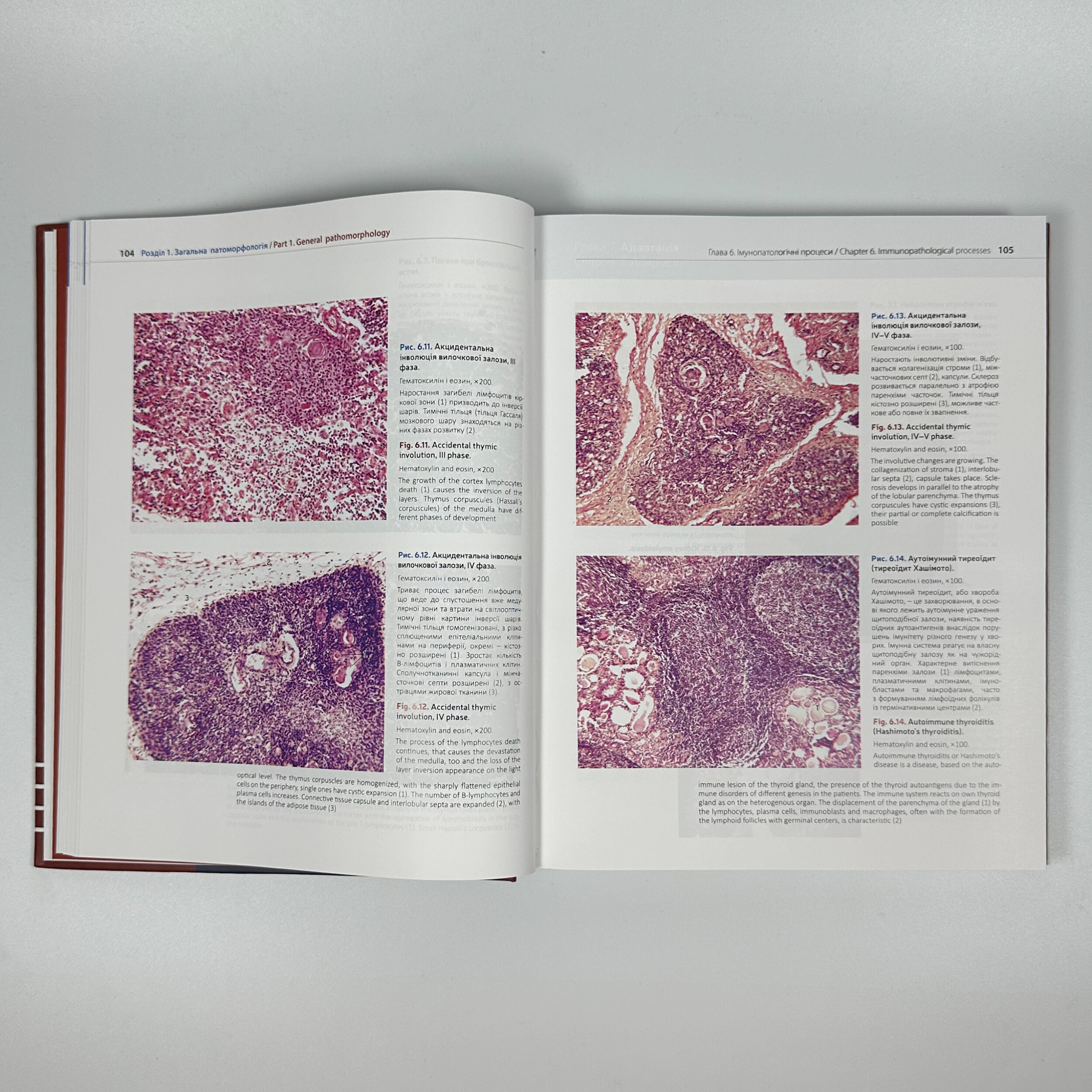Патоморфологія = Pathomorphology: атлас укр. та англ. мовами. Автор — Боднар Я.Я., Багрій М.М.. 