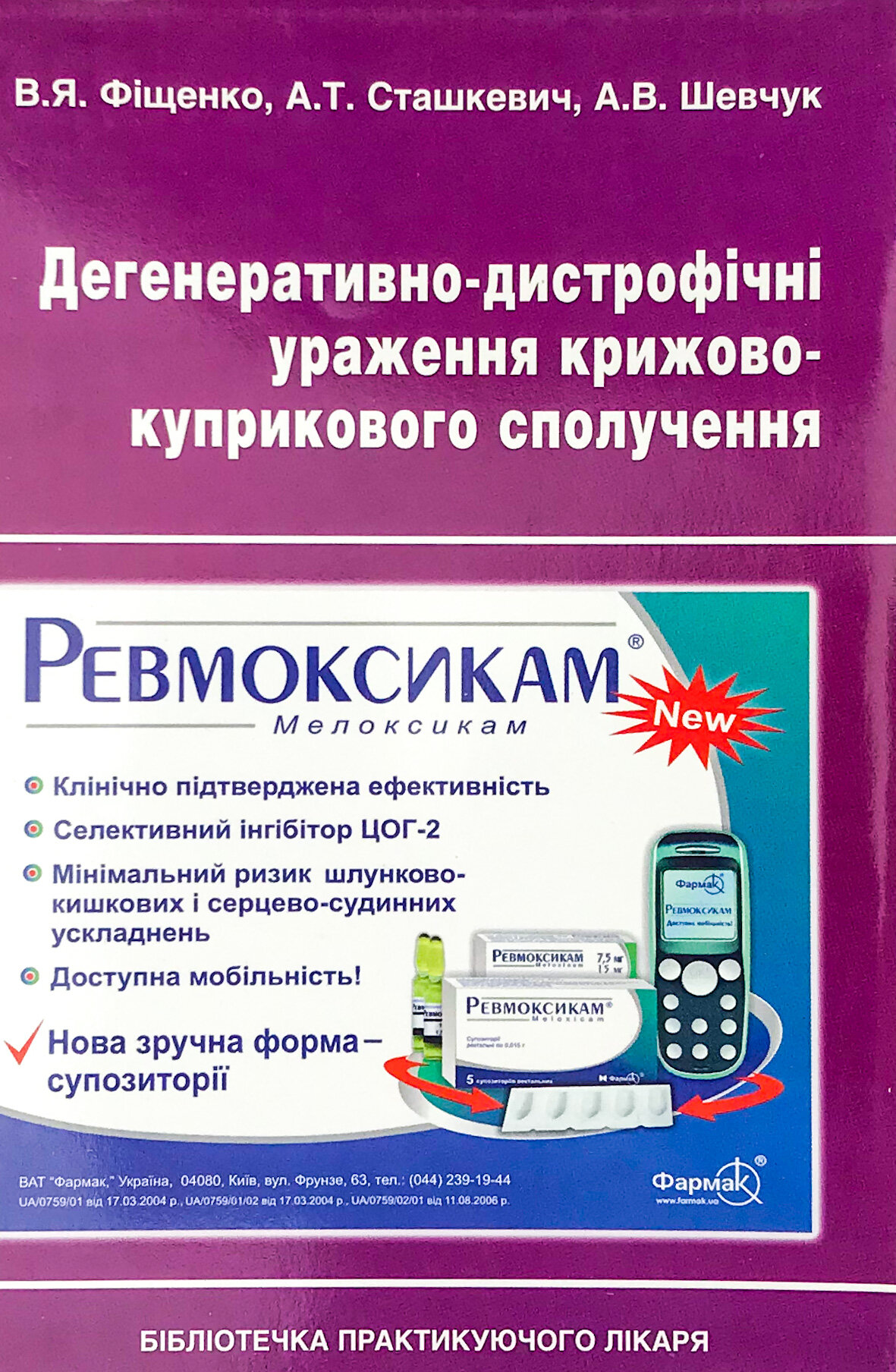 Дегенеративно-дистрофічні ураження крижово-куприкового сполучення