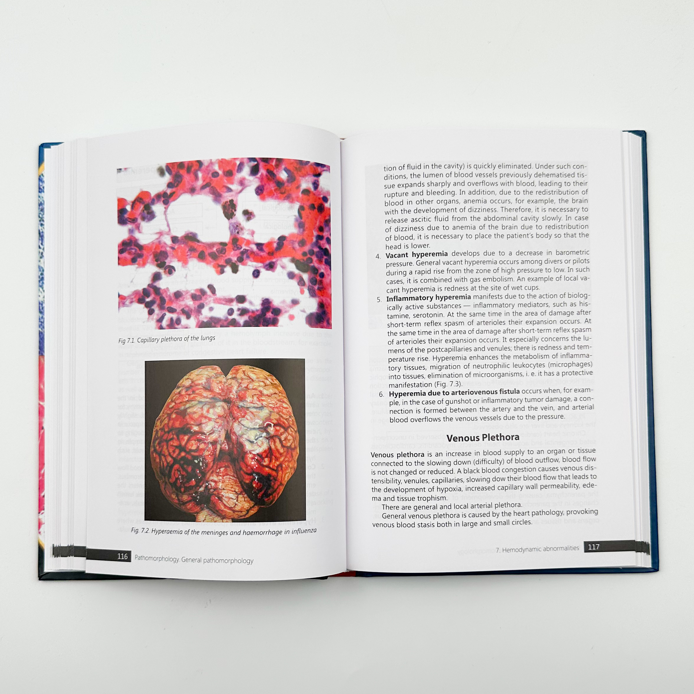 Pathomorphology. General Pathomorphology . Автор — Боднар Я.Я.. 