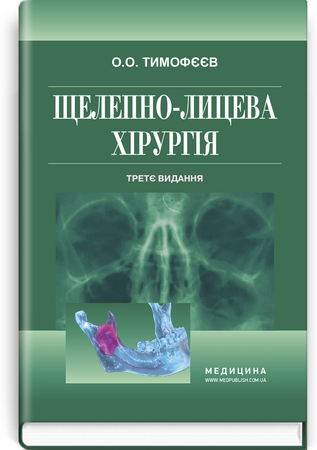Щелепно-лицева хірургія: підручник. Автор — О.О Тимофєєв. 
