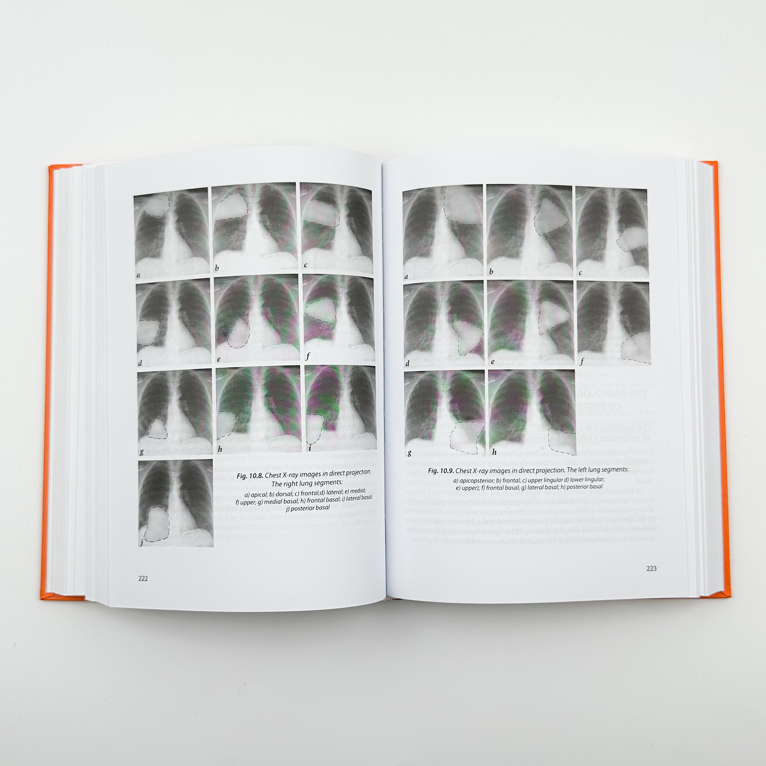 Radiology. Radiotherapy. Diagnostic Imaging. Автор — М.П. Ковальський. 