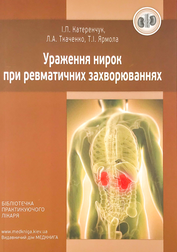 Ураження нирок при ревматичних захворюваннях. Автор — Катеренчук І.П., Ткаченко Л.А.