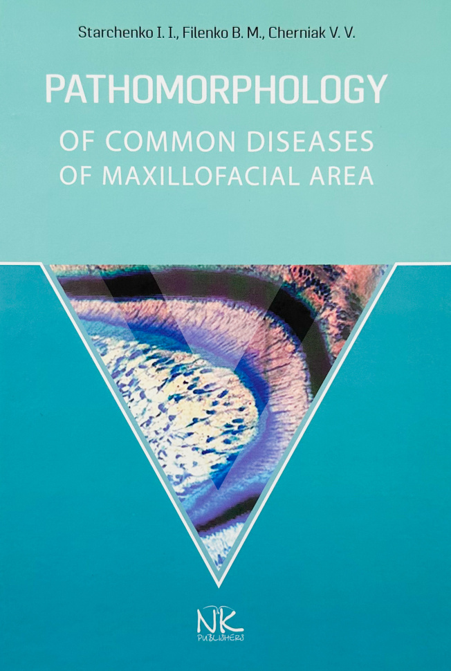 Pathomorphology of Сommon Diseases of Maxillofacial Area. Автор — Старченко І.І.. Обкладинка — твердий
