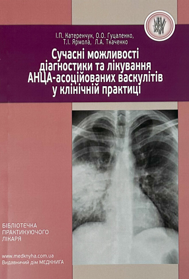 Сучасні можливості діагностики та лікування АНЦА-асоційованих васкулітів у клінічній практиці. Автор — Гуцаленко Л.В., Катеренчук І.П.. Обкладинка — М'яка