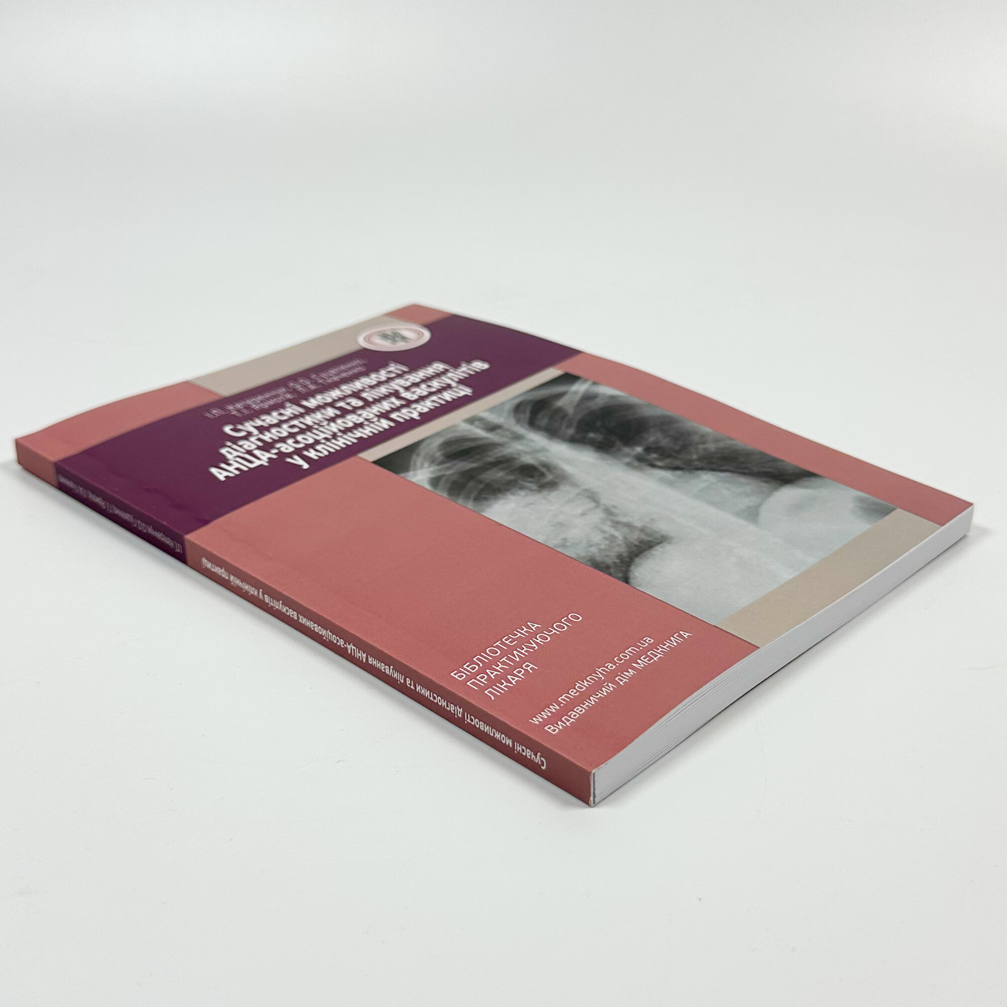 Сучасні можливості діагностики та лікування АНЦА-асоційованих васкулітів у клінічній практиці
