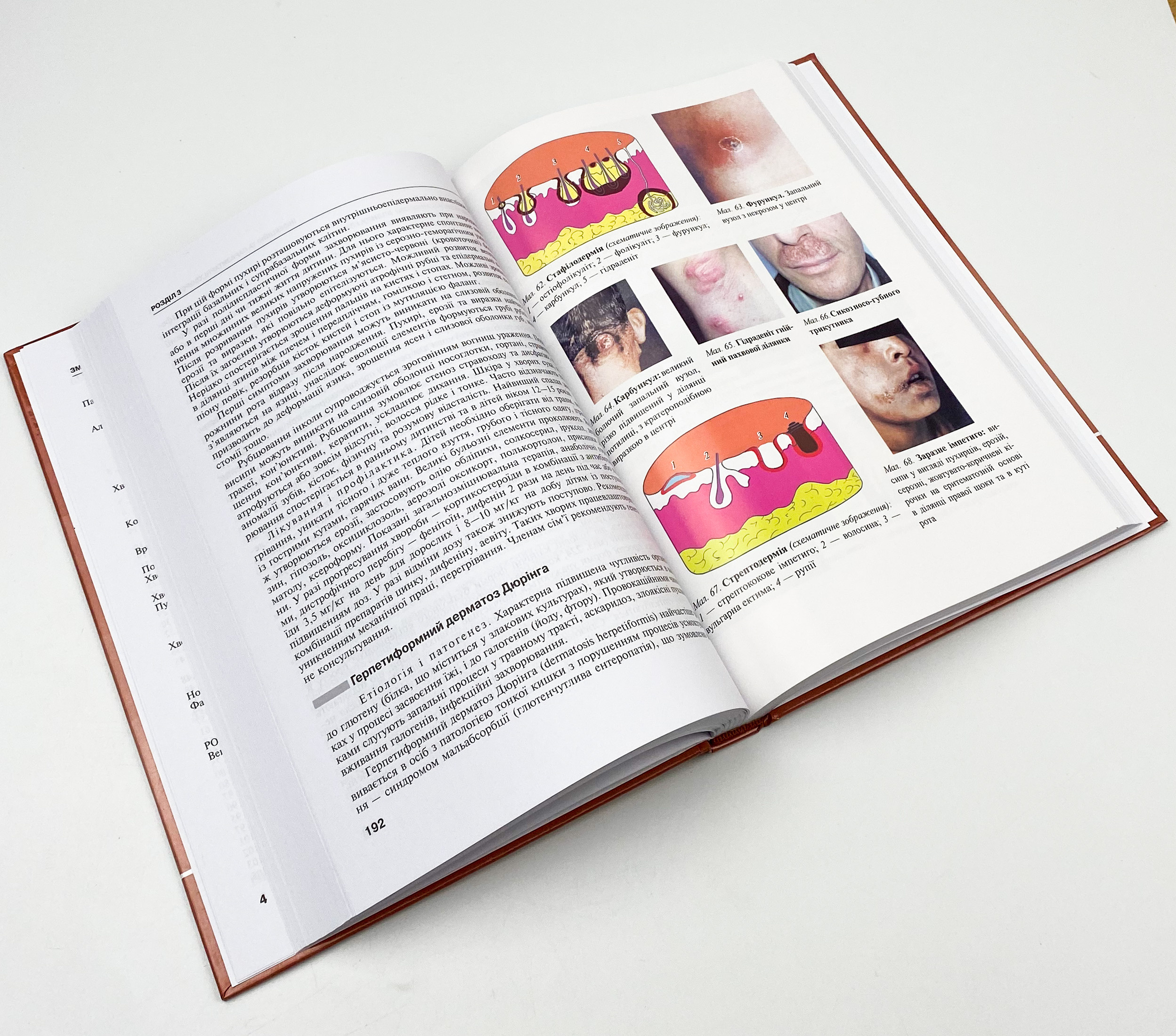 Дерматологія і венерологія. Автор — В.І Степаненко, А.І Чоботарь, С.О Бондарь. 